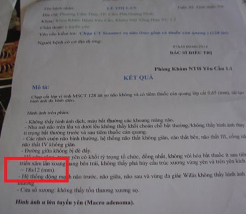 Kỳ diệu u tuyến yên co lại sau khi dùng thảo dược - ảnh 2