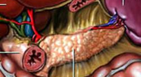 Ung thư tụy ngoại tiết: Nguyên nhân, triệu chứng, cách điều trị - ảnh 1