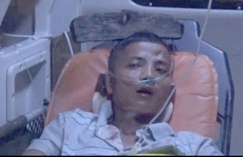 Vượt 350km cấp cứu với cây cào sắt găm vào đầu - ảnh 1