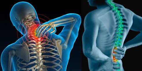 Đau mỏi vai gáy: Những cách xử lý kịp thời - ảnh 1