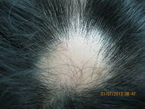 Nguyên tắc chống rụng tóc ngày đông - ảnh 1