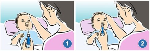 Cách vệ sinh chuẩn giúp con hết sổ mũi - ảnh 1