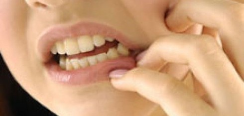 Cảnh báo thuốc đau răng, táo bón có thể gây tử vong - ảnh 1