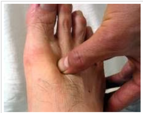 Day bấm huyệt chữa say nắng - ảnh 2