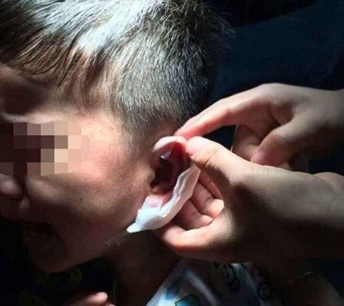 Cô giáo mầm non dùng dập ghim dập tai học sinh giờ nghỉ trưa - ảnh 1