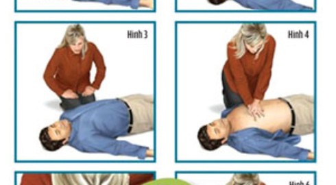 Cách hồi sức tim phổi khi nạn nhân bị đuối cạn - ảnh 1