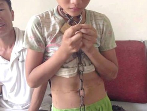 Cha xích cổ con vào gốc cây vì…quá nghịch - ảnh 2