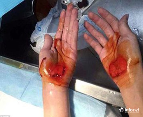 Giáo viên bắt học sinh đi bằng tay vì đi học muộn - ảnh 1