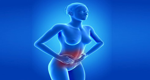 4 loại thảo dược tốt cho người bệnh viêm loét đại tràng - ảnh 1