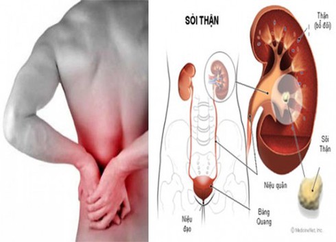 Những dấu hiệu phát hiện sớm bệnh thận - ảnh 1