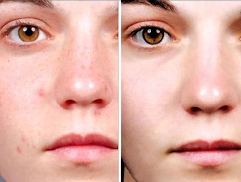 Cách thử dị ứng mỹ phẩm thông dụng - ảnh 1