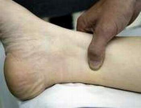 Bấm huyệt chữa liệt dương - ảnh 1