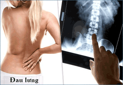 Xoa bóp chữa đau thắt lưng - ảnh 1