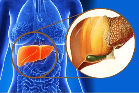 Giúp gan chống cuộc “tấn công” của thực phẩm bẩn - ảnh 1