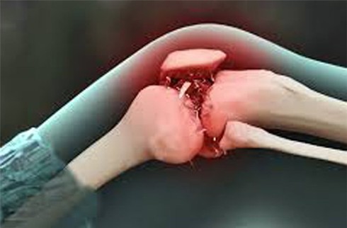 Đau trong ung thư xương di căn - ảnh 1