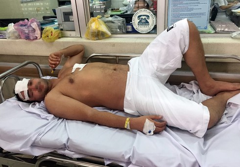 Cướp xông vào chung cư đâm người nước ngoài ở Sài Gòn - ảnh 1