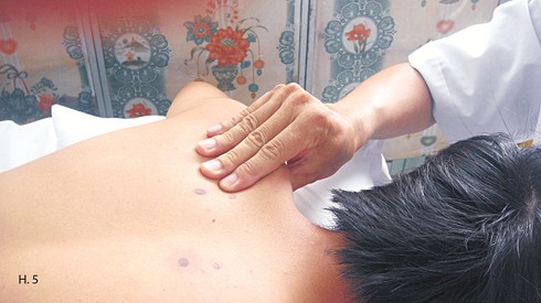 Xoa bóp chữa đau vai gáy do tư thế - ảnh 5