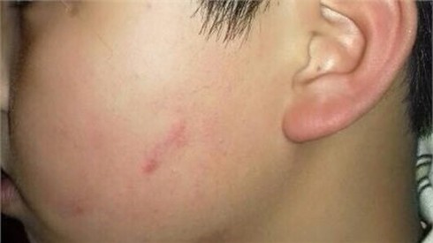 Bé trai bị 42 bạn cùng lớp tát và nỗi đau người mẹ - ảnh 1