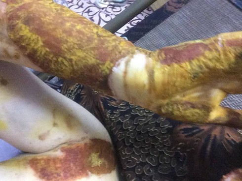 Chủ tịch Hà Nội yêu cầu xử nghiêm vụ nữ sinh lớp 12 bị bỏng - ảnh 1