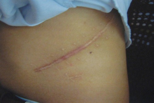 HIV/AIDS đang đe dọa trẻ đường phố