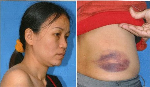 Bác sĩ bị đánh trọng thương trong ca trực