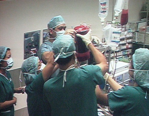 Phẫu thuật khối u khổng lồ đã thành công