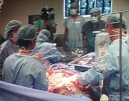 Phẫu thuật khối u khổng lồ đã thành công