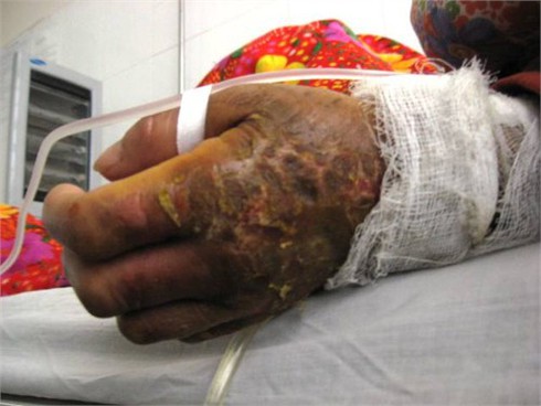 Nỗi đau mang tên `ô sin`