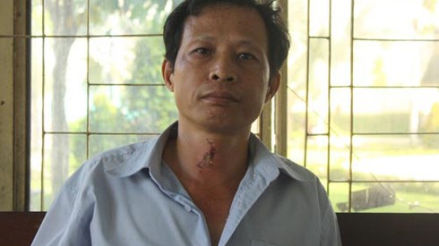 Vụ gia đình bị tạt a xít: Gia đình nạn nhân gửi đơn cầu cứu