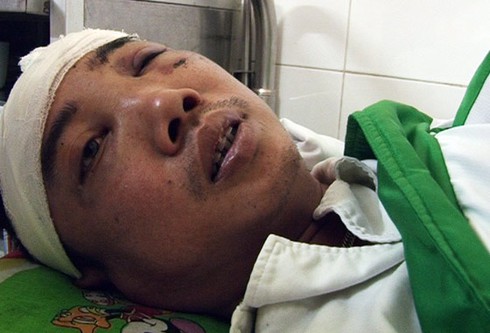 Triệu tập đối tượng đánh, cướp tài sản lái xe taxi ở Ba Vì