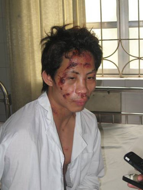 Nạn nhân kể vụ sập giàn giáo ở Mỗ Lao