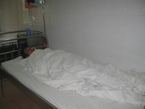 Nạn nhân kể vụ sập giàn giáo ở Mỗ Lao