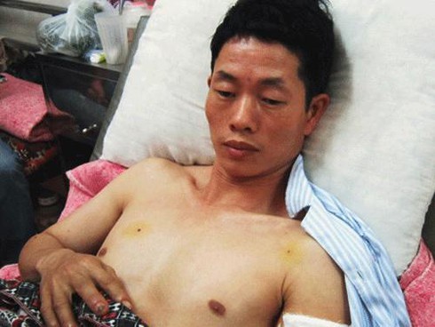 Nổ lò nấu thép: Hai người thiệt mạng, 6 người bị thương