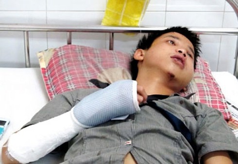 Đà Nẵng: Tạm đình chỉ bảo vệ KTX nghi đánh sinh viên chấn thương