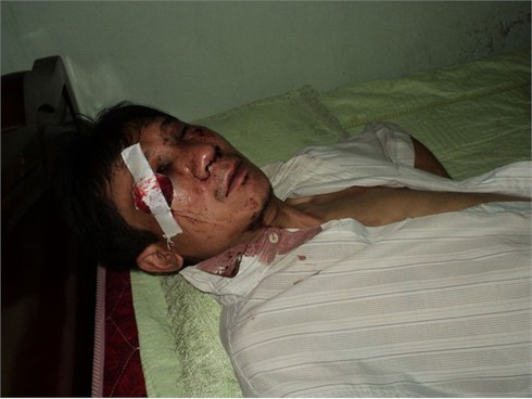 Hà Nội: Đánh người thương tích, cướp xe ôm giữa ban ngày