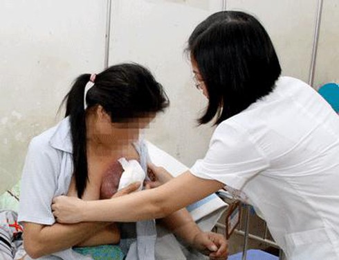 Mất ngực vì đắp thuốc nam chữa ung thư vú