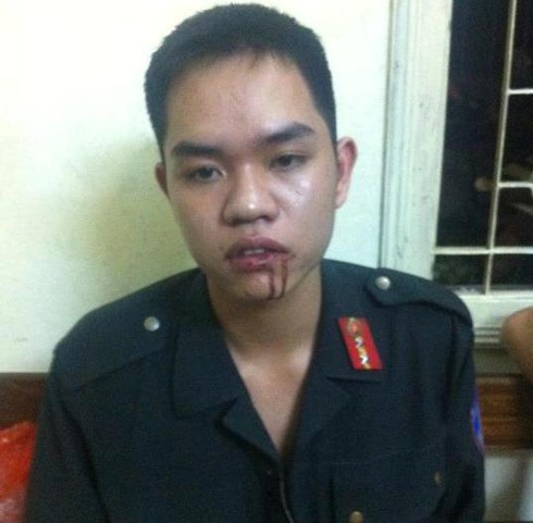 Vi phạm giao thông, nữ sinh viên đấm chảy máy mồm CSCĐ