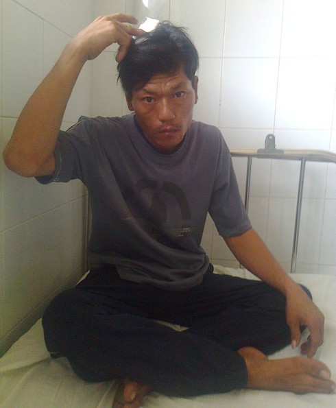 Bình Dương: Dân quân xã vô cớ đánh người gây thương tích!