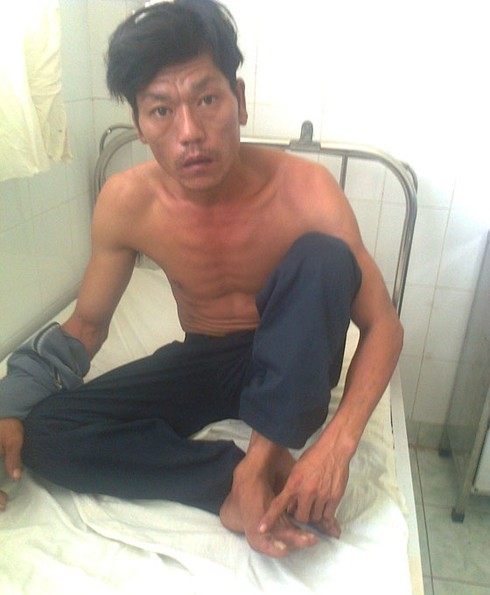 Bình Dương: Dân quân xã vô cớ đánh người gây thương tích!