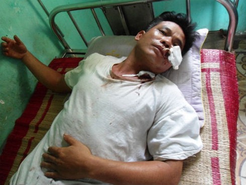 Côn đồ bịt mặt xông vào nhà rượt chém cả gia đình