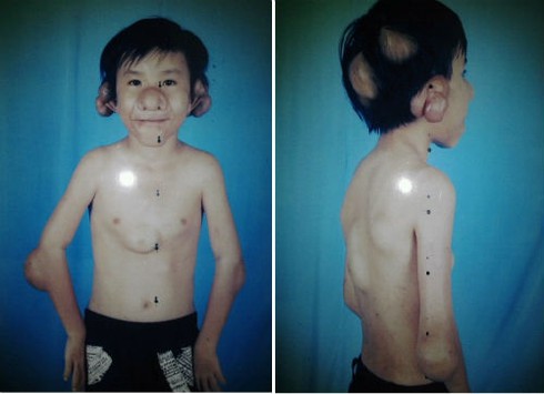 Xót xa cảnh đời cậu bé 'Trư Bát Giới'