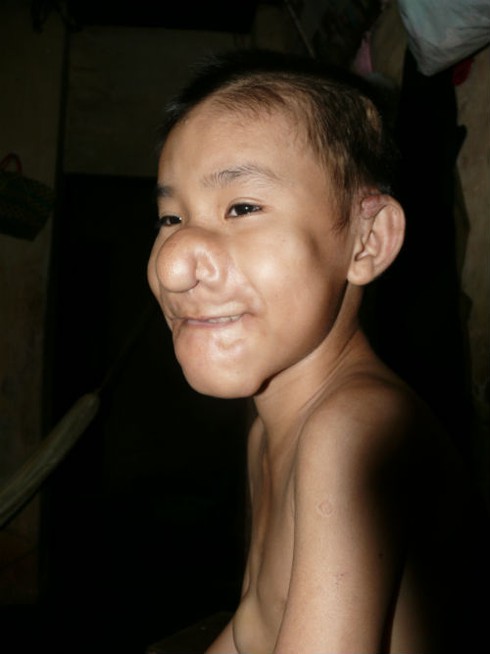 Xót xa cảnh đời cậu bé 'Trư Bát Giới'