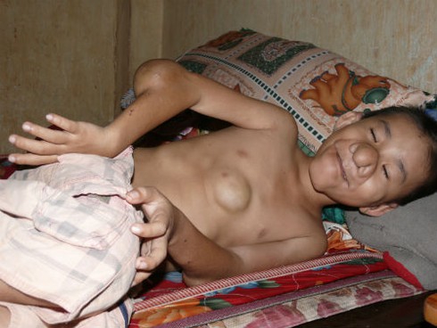 Xót xa cảnh đời cậu bé 'Trư Bát Giới'