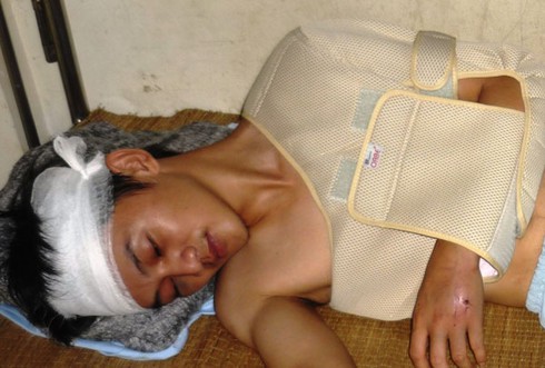 Hai thanh niên giả danh công an đi trấn lột sa lưới