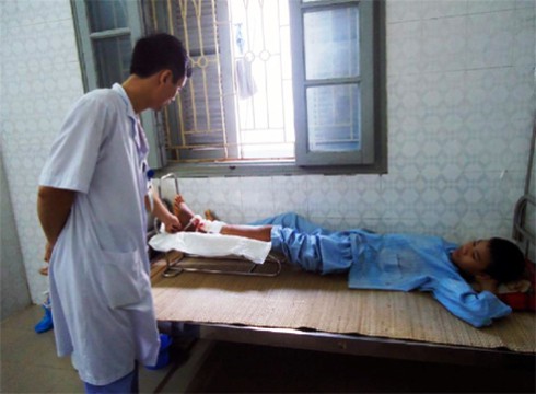 Nguy kịch vì đắp thuốc chữa gãy xương