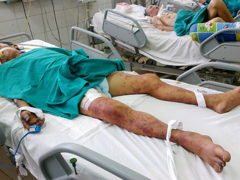 Chết vì tiết canh