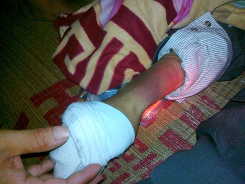 Khởi tố, bắt tạm giam 4 công an xã đánh chết người