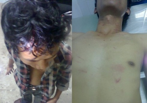 Trưởng BCH quân sự thị trấn hành hung người vi phạm giao thông