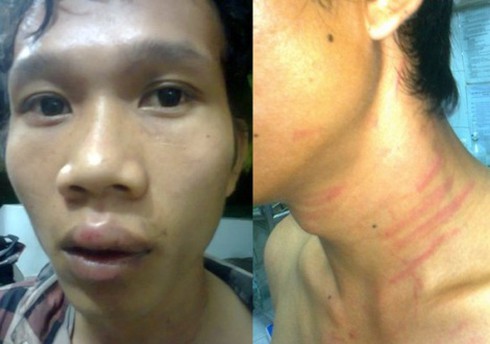 Trưởng BCH quân sự thị trấn hành hung người vi phạm giao thông