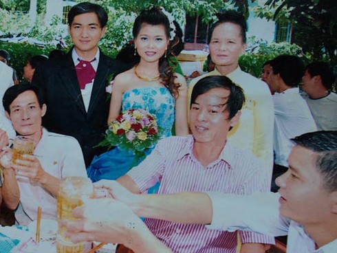 Bệnh lạ khiến một người sụt 40kg, lột da